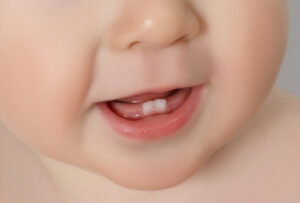 первые зубы у грудничка